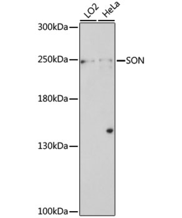 SON Rabbit Polyclonal Antibody