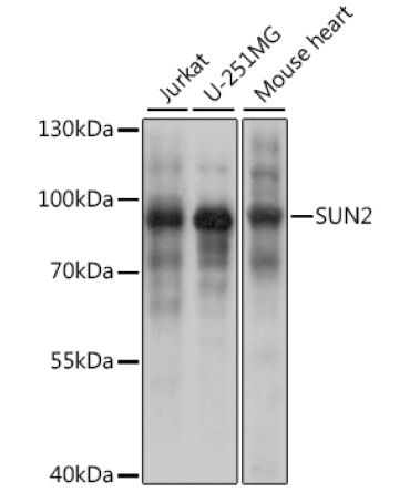 SUN2 Rabbit Polyclonal Antibody