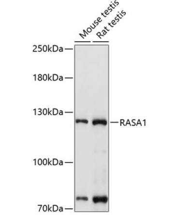RASA1 Rabbit Polyclonal Antibody