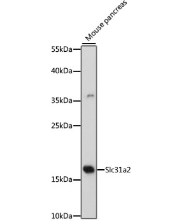 Slc31a2 Rabbit Polyclonal Antibody