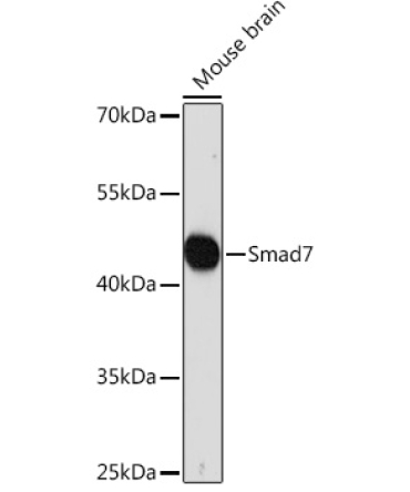 Smad7 Rabbit Polyclonal Antibody