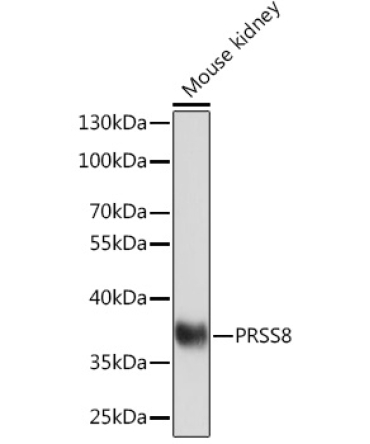 PRSS8 Rabbit Polyclonal Antibody