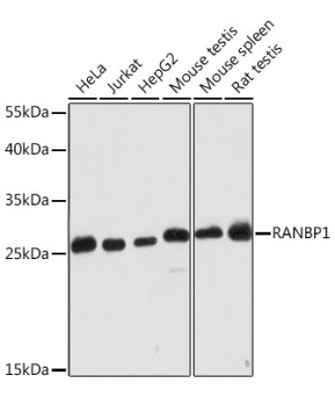 RANBP1 Rabbit Polyclonal Antibody