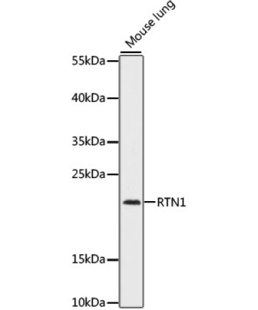 RTN1 Rabbit Polyclonal Antibody