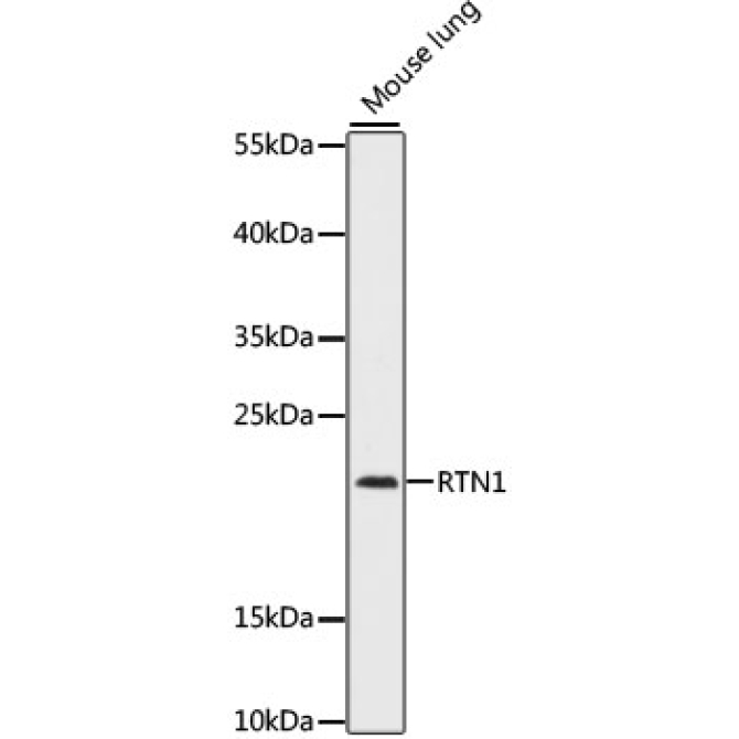 RTN1 Rabbit Polyclonal Antibody