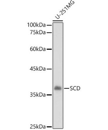 SCD Rabbit Polyclonal Antibody