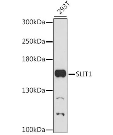 SLIT1 Rabbit Polyclonal Antibody