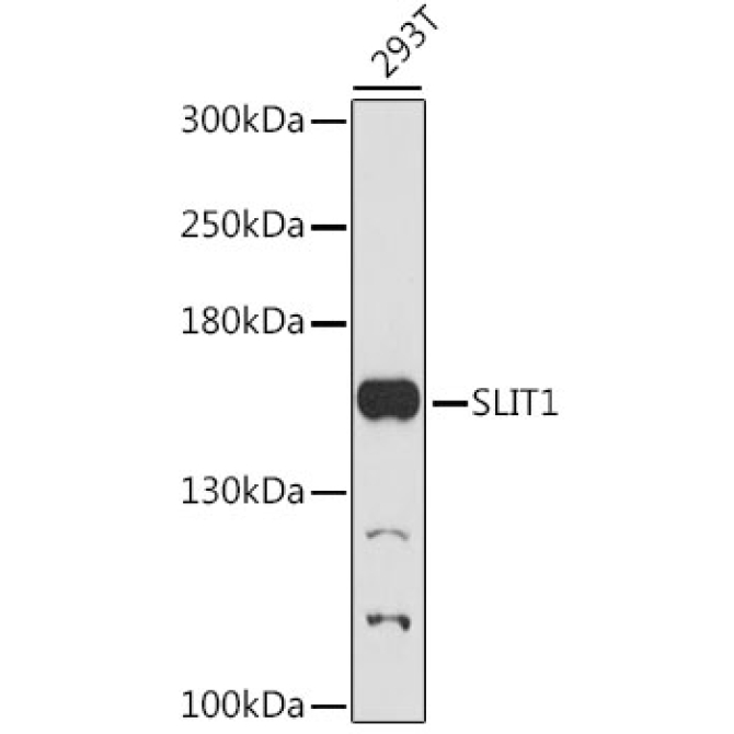 SLIT1 Rabbit Polyclonal Antibody