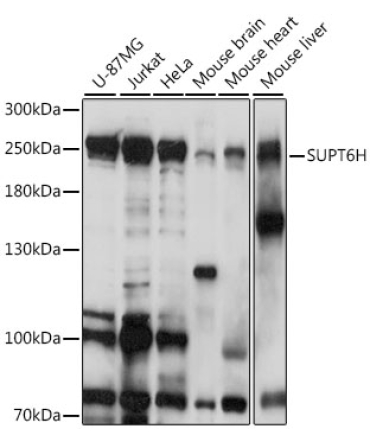 SUPT6H Rabbit Polyclonal Antibody