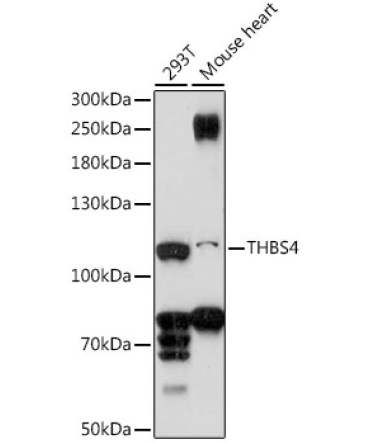 THBS4 Rabbit Polyclonal Antibody