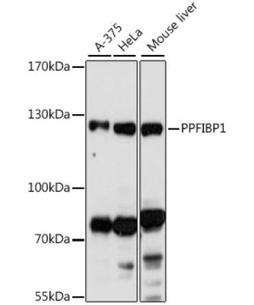 PPFIBP1 Rabbit Polyclonal Antibody