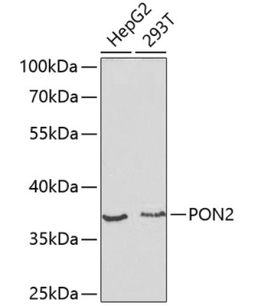 PON2 Rabbit Polyclonal Antibody