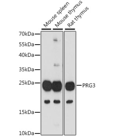 PRG3 Rabbit Polyclonal Antibody