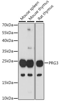 PRG3 Rabbit Polyclonal Antibody