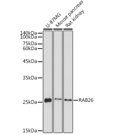 RAB26 Rabbit Polyclonal Antibody