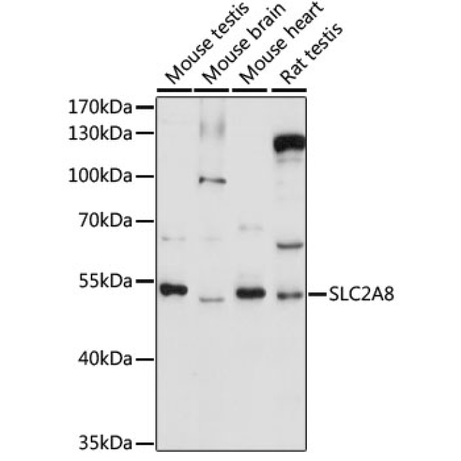 SLC2A8 Rabbit Polyclonal Antibody