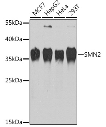SMN2 Rabbit Polyclonal Antibody