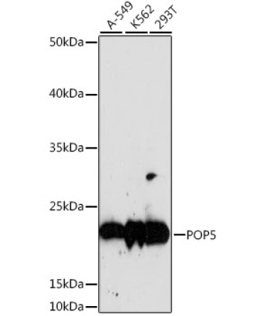 POP5 Rabbit Polyclonal Antibody