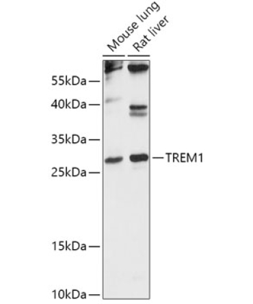 TREM1 Rabbit Polyclonal Antibody