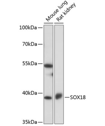 SOX18 Rabbit Polyclonal Antibody