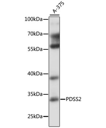 PDSS2 Rabbit Polyclonal Antibody