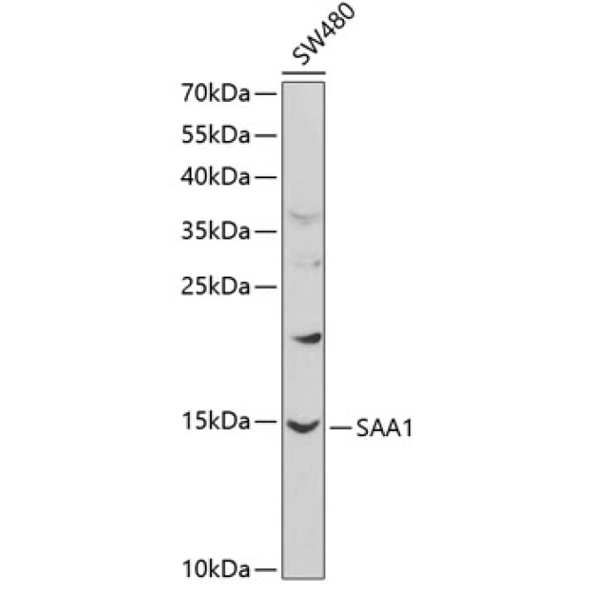 SAA1 Rabbit Polyclonal Antibody