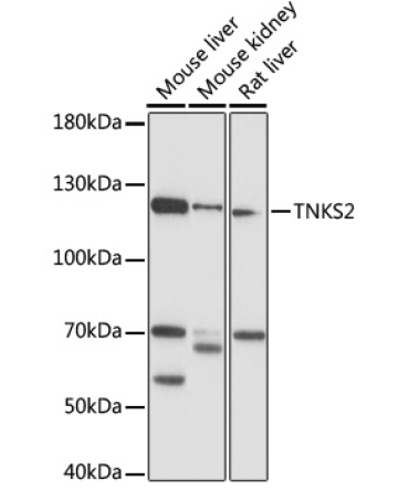 TNKS2 Rabbit Polyclonal Antibody
