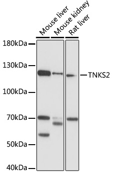 TNKS2 Rabbit Polyclonal Antibody