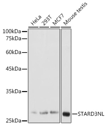 STARD3NL Rabbit Polyclonal Antibody