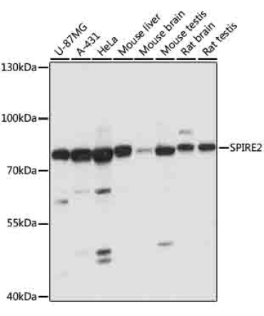 SPIRE2 Rabbit Polyclonal Antibody
