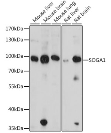 SOGA1 Rabbit Polyclonal Antibody