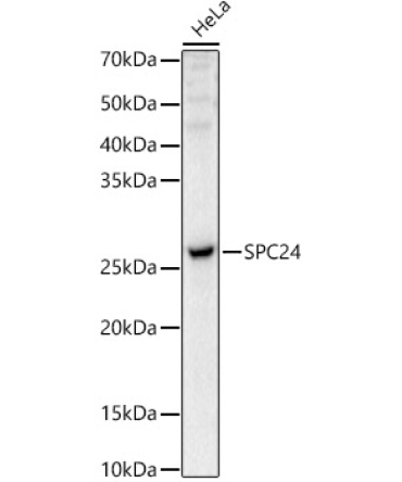 SPC24 Rabbit Polyclonal Antibody