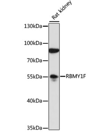 RBMY1F Rabbit Polyclonal Antibody