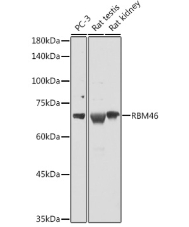 RBM46 Rabbit Polyclonal Antibody