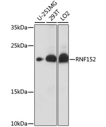 RNF152 Rabbit Polyclonal Antibody