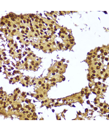 TERT Rabbit Polyclonal Antibody