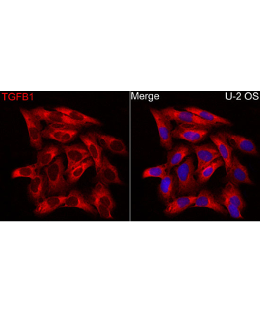 TGF beta 1 Rabbit Polyclonal Antibody