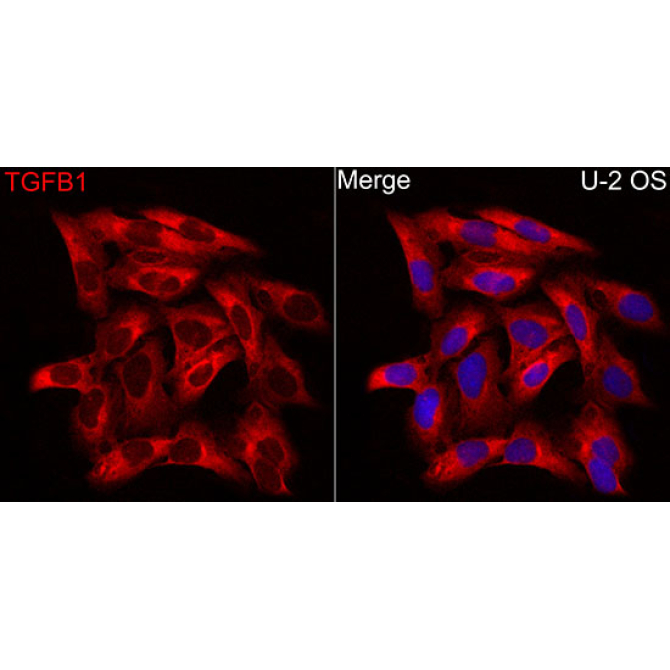TGF beta 1 Rabbit Polyclonal Antibody