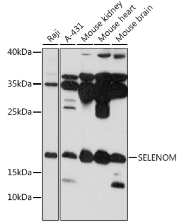 SELENOM Rabbit Polyclonal Antibody
