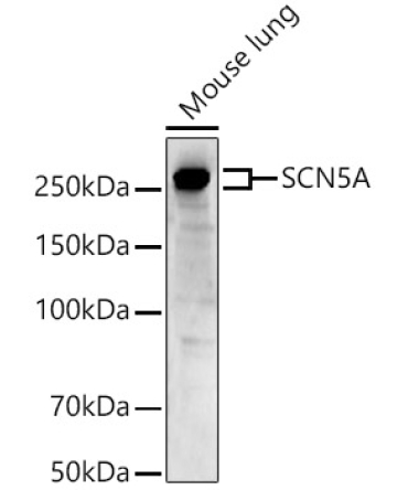 SCN5A Rabbit Polyclonal Antibody