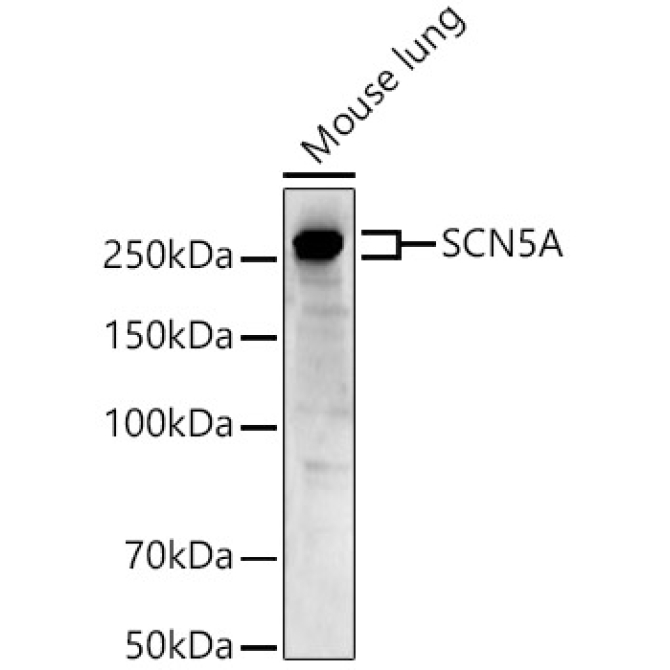 SCN5A Rabbit Polyclonal Antibody