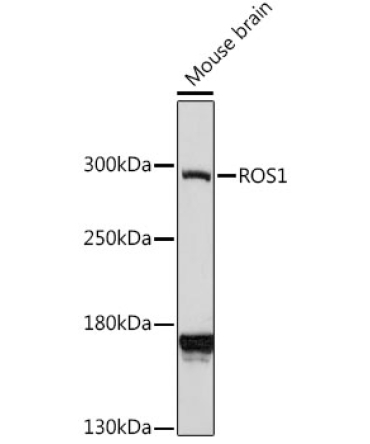 ROS1 Rabbit Polyclonal Antibody