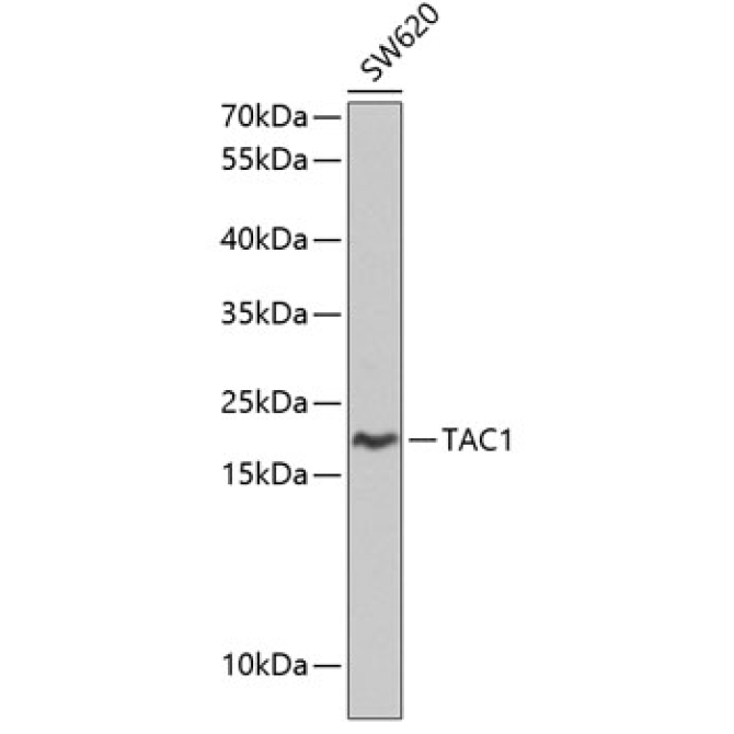 TAC1 Rabbit Polyclonal Antibody