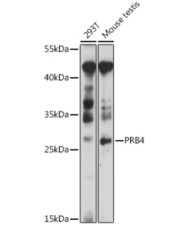 PRB4 Rabbit Polyclonal Antibody