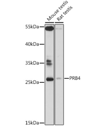 PRB4 Rabbit Polyclonal Antibody