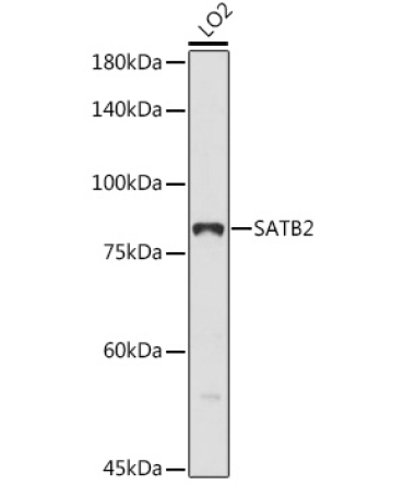 SATB2 Rabbit Polyclonal Antibody