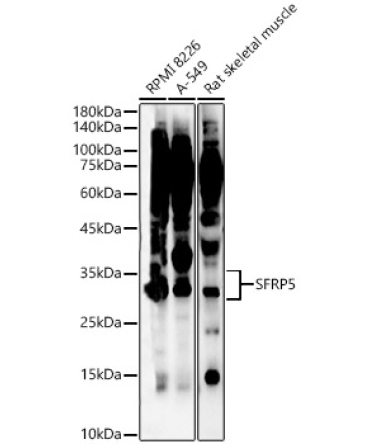 SFRP5 Rabbit Polyclonal Antibody