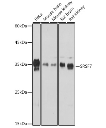 SRSF7 Rabbit Polyclonal Antibody