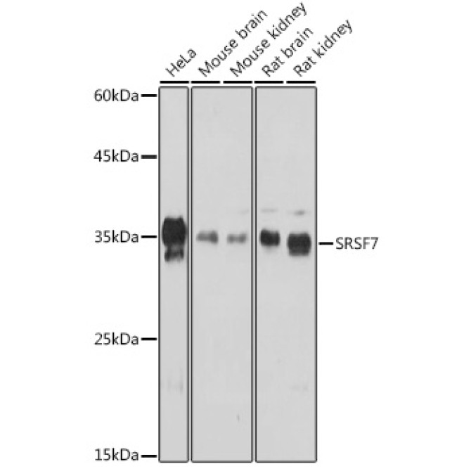SRSF7 Rabbit Polyclonal Antibody