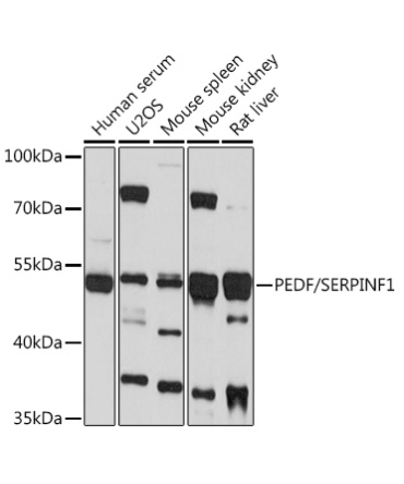 PEDF/SERPINF1 Rabbit Polyclonal Antibody